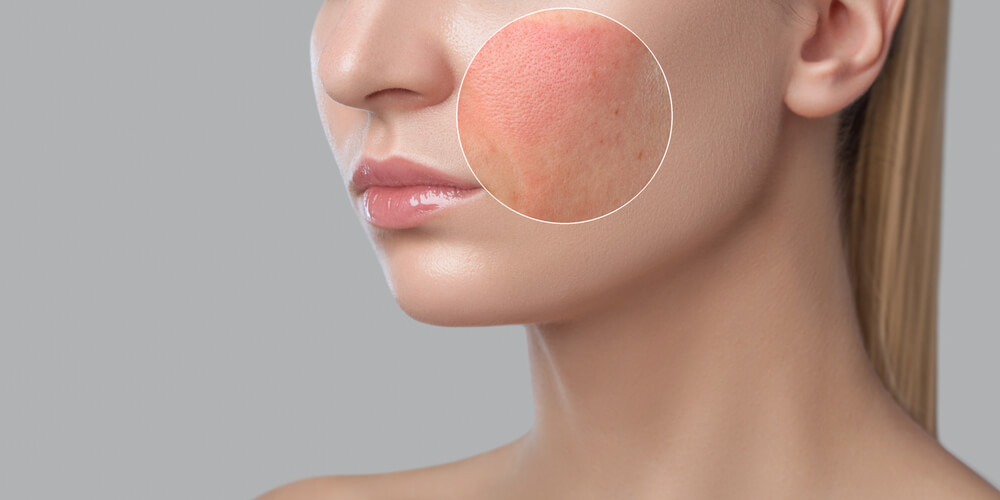 closeup face inflammation