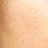 large pores