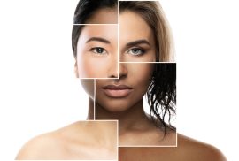 skin types